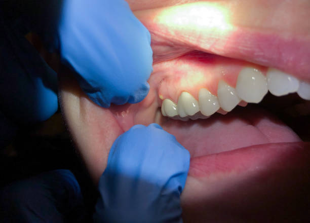 Best Pediatric Emergency Dentist in Ronkonkoma, NY